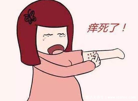 皮肤痒是身体哪里出问题了,冬天可能与频繁洗澡有关(警惕内科疾病)