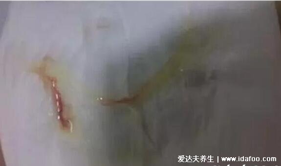 九价疫苗是干什么的什么意思,预防HPV病毒可能导致的宫颈癌