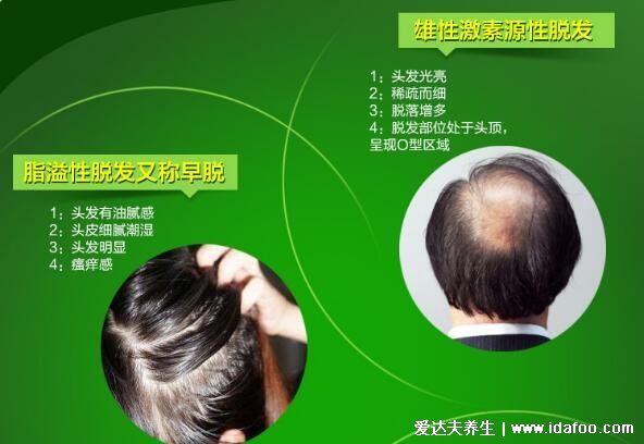 仁和匠心防脱育发液效果怎样,央视已曝光大家擦亮眼睛