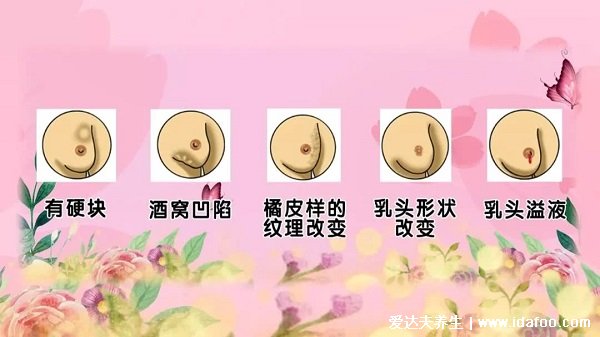 女性乳腺癌图片早期症状,乳头表面出现溢液要注意(乳房肿块4大症状)