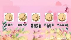 女性乳腺癌图片早期症状,乳头表面出现溢
