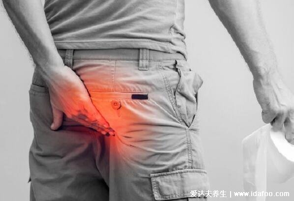 真实的外痔疮图片长什么样?能摸到肛门口有个肉球(附自愈方法)
