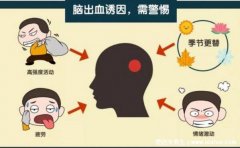 脑出血前有8个征兆，警惕经常喝水被呛到还