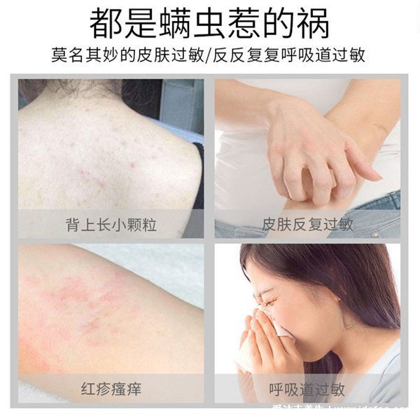 被跳蚤咬的症状图片,大小不一暗红色疹子(袜口腰带部位出现)