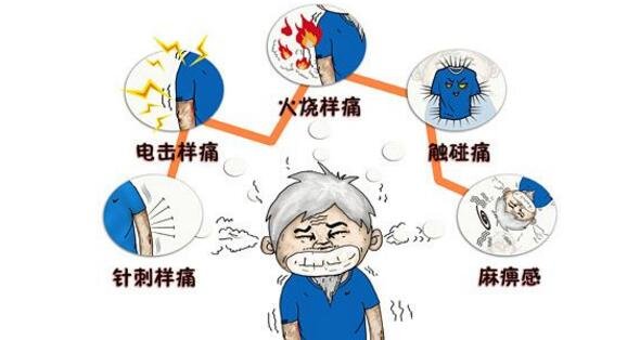 三叉神经痛是哪个部位图解,面部口腔下颌中某一点的剧烈抽痛