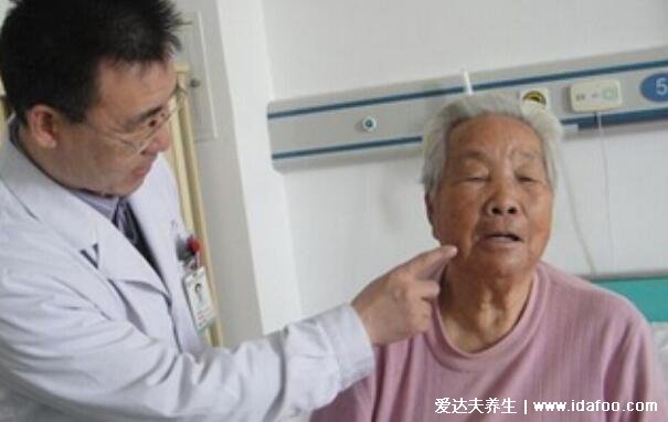 三叉神经痛是哪个部位图解,面部口腔下颌中某一点的剧烈抽痛