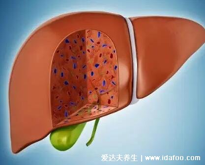 保肝护肝最好的药排名,护肝片是常见药物(附调肝食物)