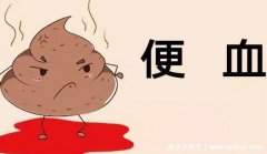 4个最为明显的肠癌信号,腹痛还便血要警惕