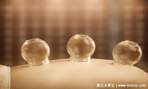 拔罐后多长时间可以洗澡,3小时内不能洗附拔罐后注意事项