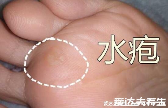 100种皮肤病对照表，各种皮肤病对照图片大全及症状