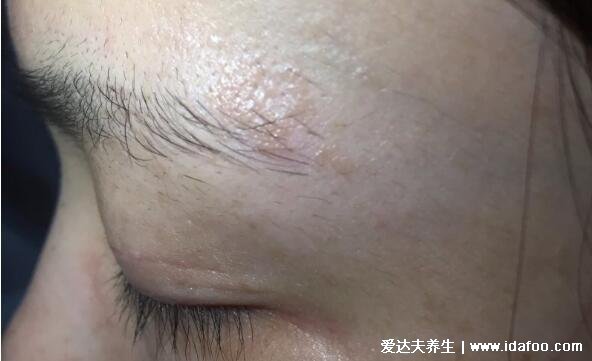 100种皮肤病对照表，各种皮肤病对照图片大全及症状