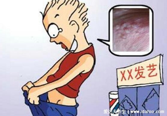 早期生殖疱疹的症状和治疗，长水疱伴随瘙痒疼痛(附男女图片)