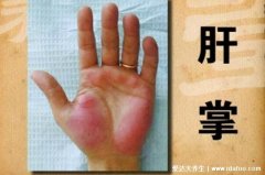 男性肝脏不好的4个表现,警惕面色蜡黄发黑