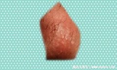 真实男女下面尖湿锐早期图片，柔软细小的