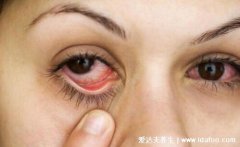 真实初期红眼病图片及症状,眼睛发红眼屎