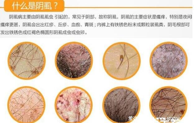 长了阴虱虫内裤的图片,内裤上有铁锈样粉末私处瘙痒难忍