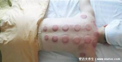 正确女性拔罐去湿气的位置图，背部脊柱两