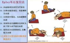 耳石症快速自愈方法，自我复位法15分钟见效