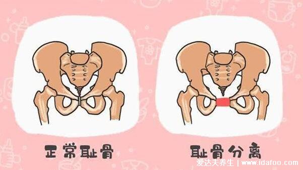 耻骨是哪个部位图片,大腿根部和小腹交界的位置(孕妇必看)