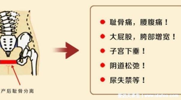 耻骨是哪个部位图片,大腿根部和小腹交界的位置(孕妇必看)