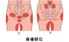 耻骨是哪个部位图片，大腿根部和小腹交界