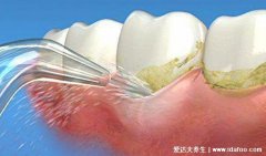 用了冲牙器牙龈萎缩了,可能是这几个方面