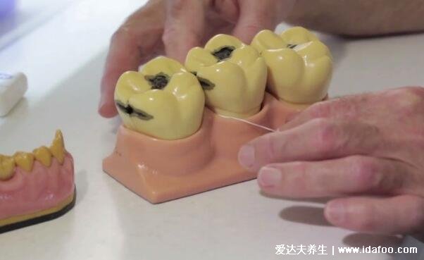 用了冲牙器牙龈萎缩了,可能是这几个方面没做到位
