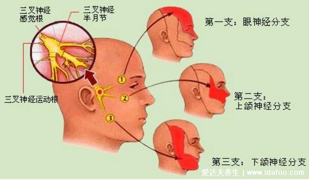 十二级疼痛排行榜牙疼仅排第五,三叉神经痛又称天下第一痛