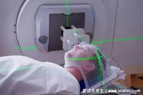 为什么放疗结束都活不长,很多人都扛不过心理折磨这关