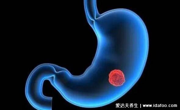 做了无痛胃镜后很后悔,其实并不可怕5分钟就完事(6种情况必须做)