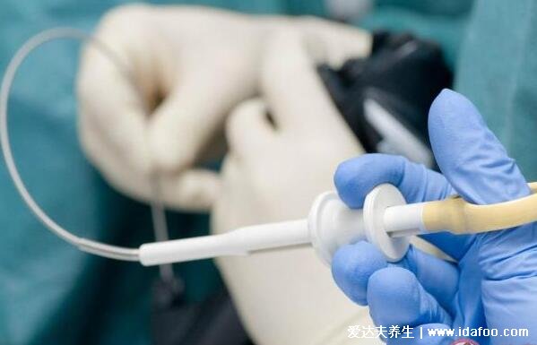 做了无痛胃镜后很后悔,其实并不可怕5分钟就完事(6种情况必须做)