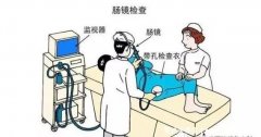 肠镜为什么尽量不要做,很多人忍受不了过