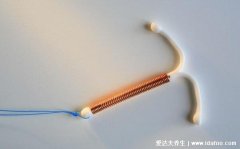 为什么不建议女人上环，4大副作用对女人的