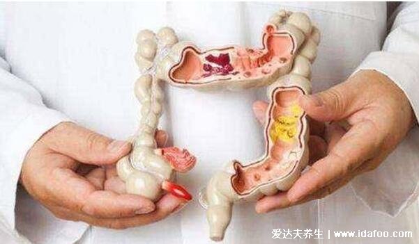 直肠癌早期的5大症状,左下腹肛门隐隐作痛伴随大便变细带血