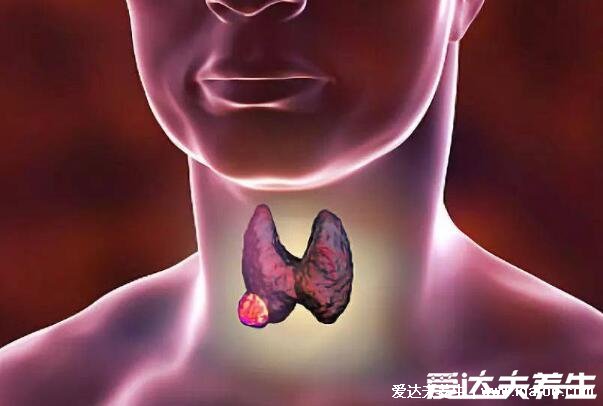 乳腺癌晚期能活多久,乳腺癌早期症状图片