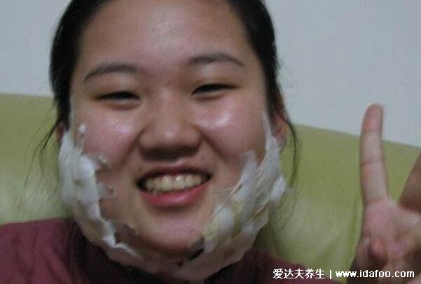 腮腺炎的症状图片,高烧后出现耳垂周围部位肿大(警惕并发症)