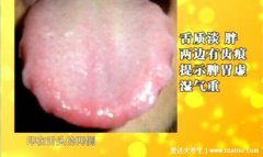 脾虚的表现和症状,舌苔白厚舌头呈锯齿状