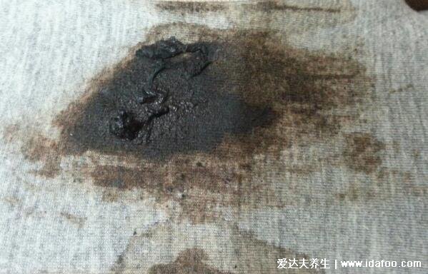 女孩初潮前的白带图片及症状,红棕色带有少量血丝的白带
