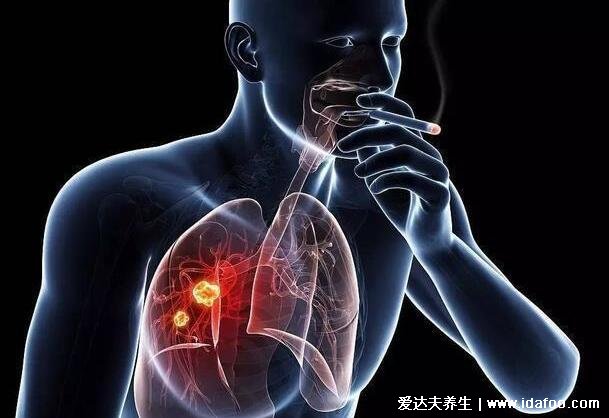 肺癌背疼位置图,上背部疼放射至胳膊痛胸痛(附晚期症状)