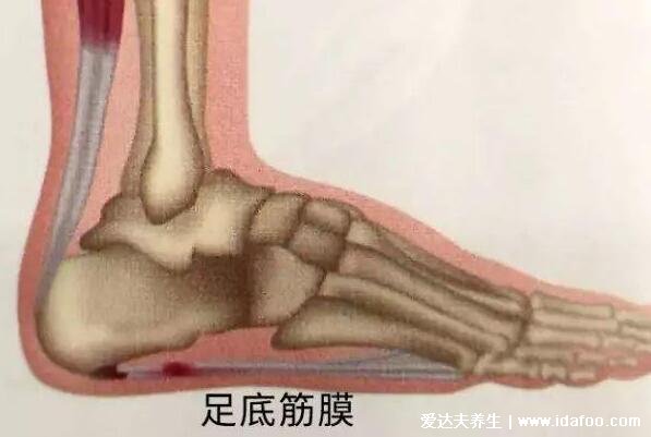脚底疼痛部位图解,脚心疼很可能是足底筋膜炎(这些位置疼需注意)