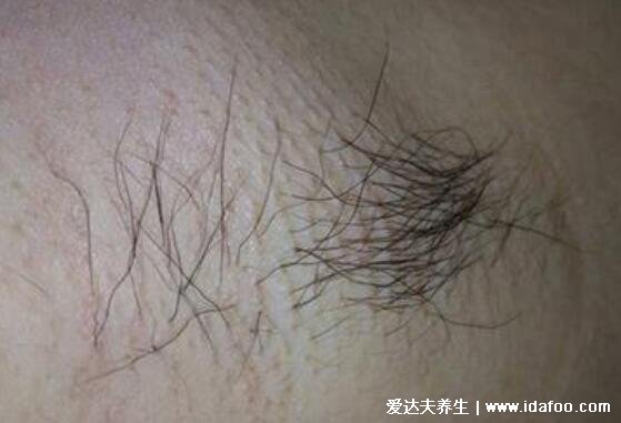 腋下淋巴癌早期症状图片,腋下红肿有明显瘙痒感会扩散