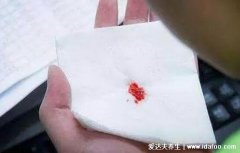 喉癌的早期症状和前兆，警惕喉癌的5大早期