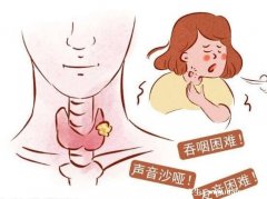 喉咙异物感一个月喉癌可能性不大,可能是