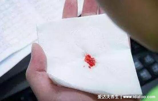 喉咙异物感一个月喉癌可能性不大,可能是因为慢性咽炎引起