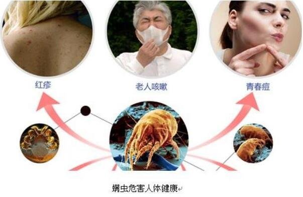 人身上被螨虫咬的图片,前胸后背长红疙瘩皮肤肉眼可见的变差