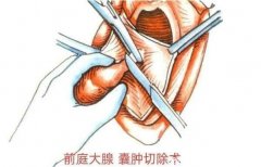 前庭大腺囊肿图片和症状,长硬块伴随疼痛