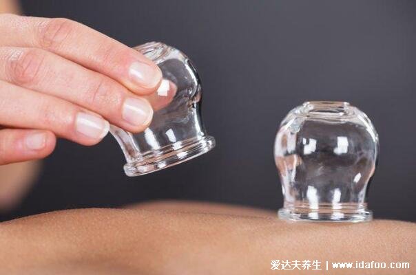 拔罐能去除体内湿气吗,拔罐的好处和坏处(能祛寒湿)