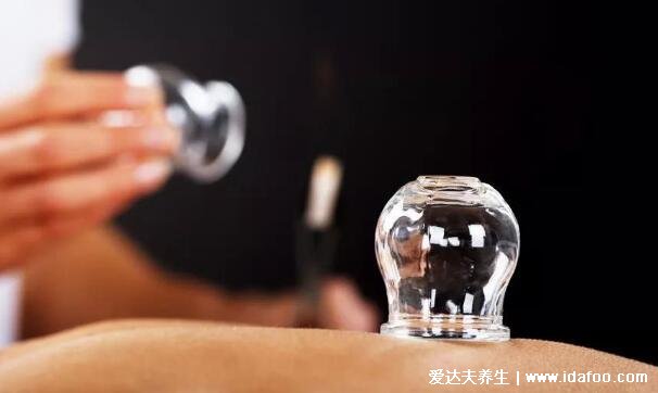 拔罐能去除体内湿气吗,拔罐的好处和坏处(能祛寒湿)