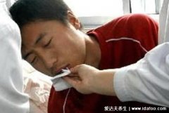 肝病的七个征兆,有毛细血管扩张的蜘蛛痣