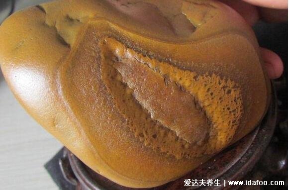 石女是怎样的身体，不来月经无法性交更不能生育(真假石女)